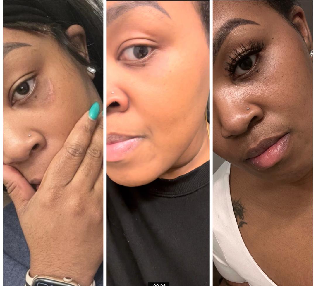 Retinol Eye Cream/Scar Relief & fading cream