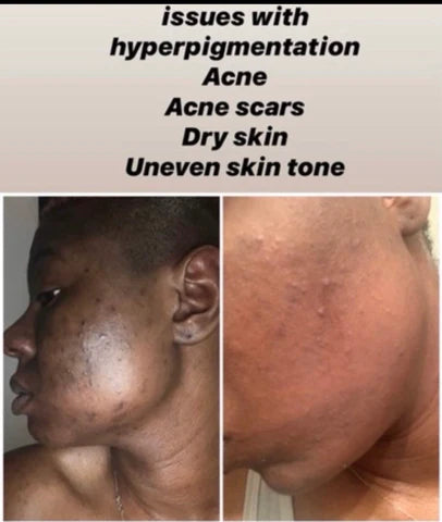 Turmeric Cleanser & Wash with Kojic Acid