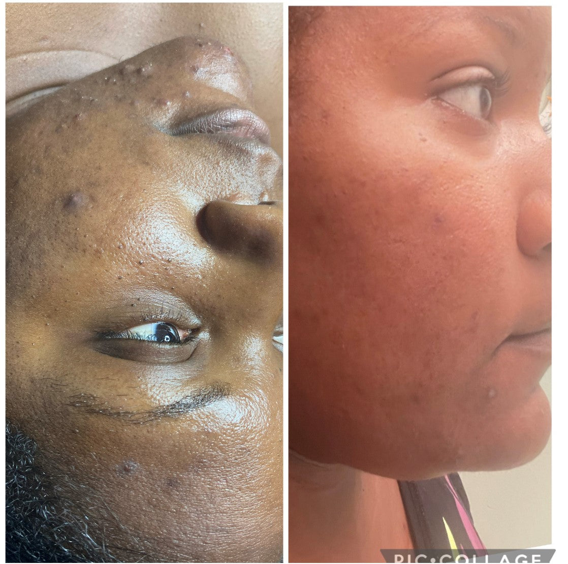 Tea Tree Cleanser
