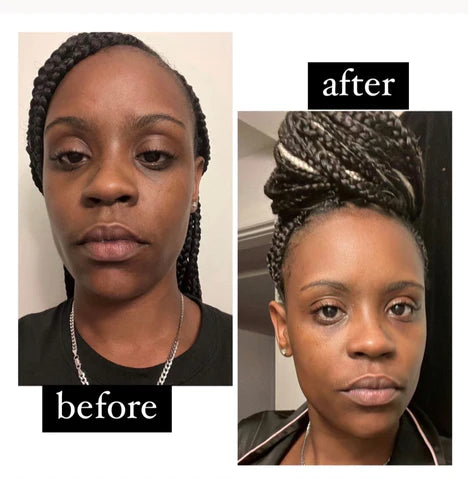 Turmeric Cleanser & Wash with Kojic Acid